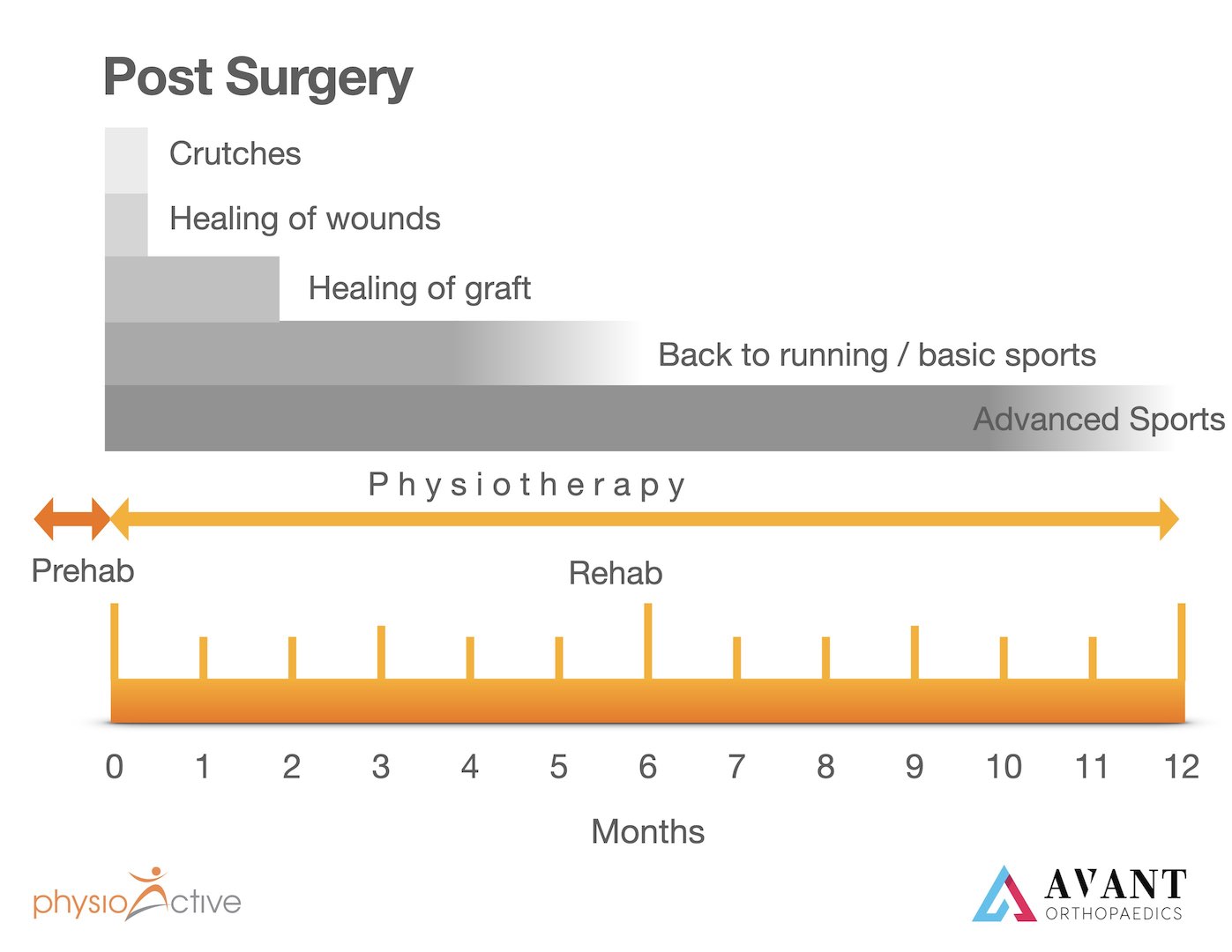 Acl Repair Reconstruction With Dr Ramesh Subramaniam Physioactive