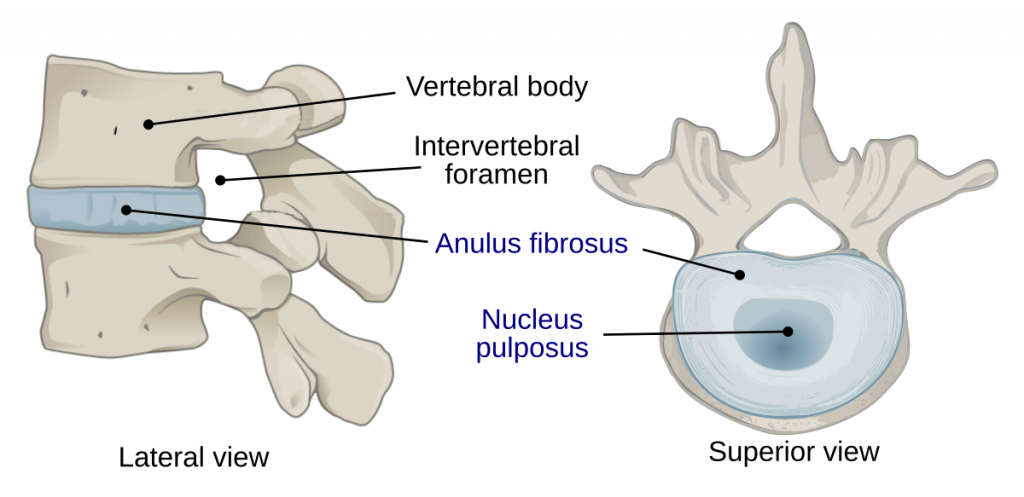 Singapore Surgeon Insights: Herniated Nucleus Pulposus - Dr Hee Hwan ...